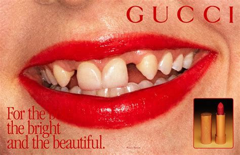 gucci lipstick and bad teeth